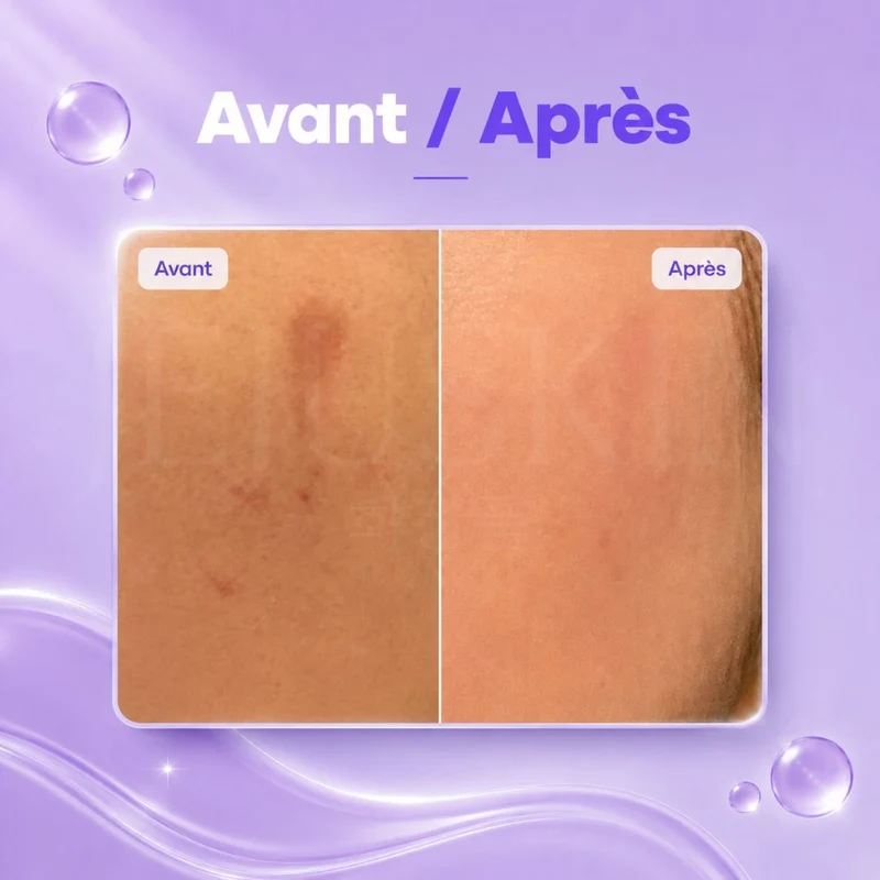 Nine Less - Sérum anti-taches B-Boost à 1% d’acide kojique - 30ml