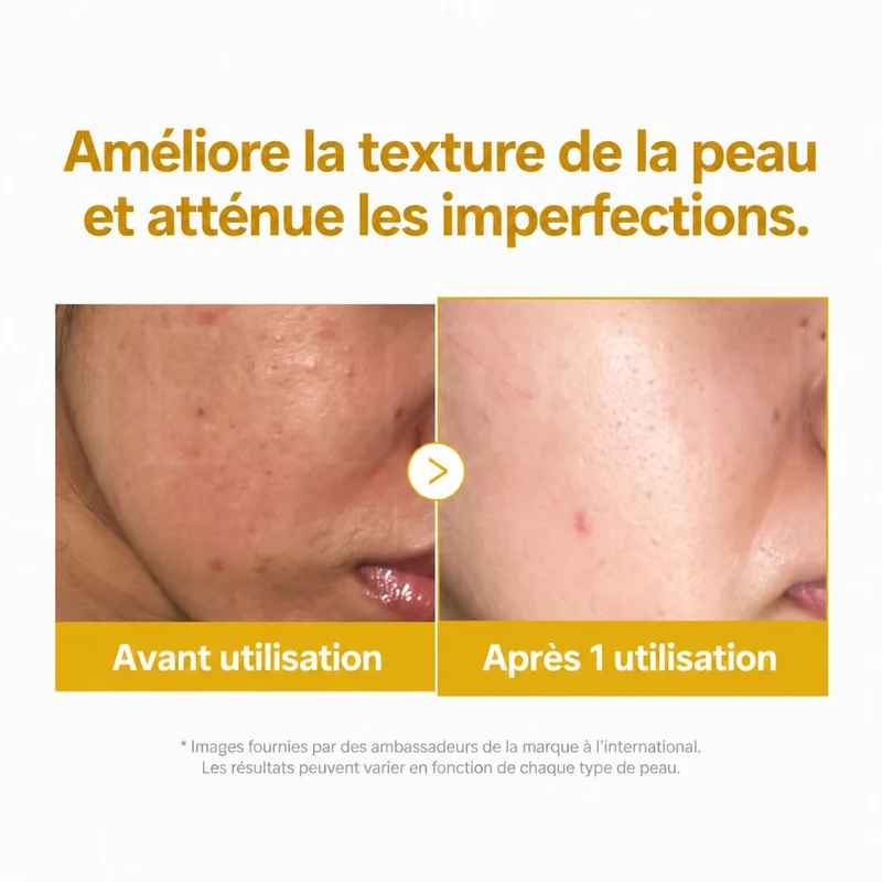 Medicube - Masque de nuit à l’acide kojique et au curcuma - 75ml