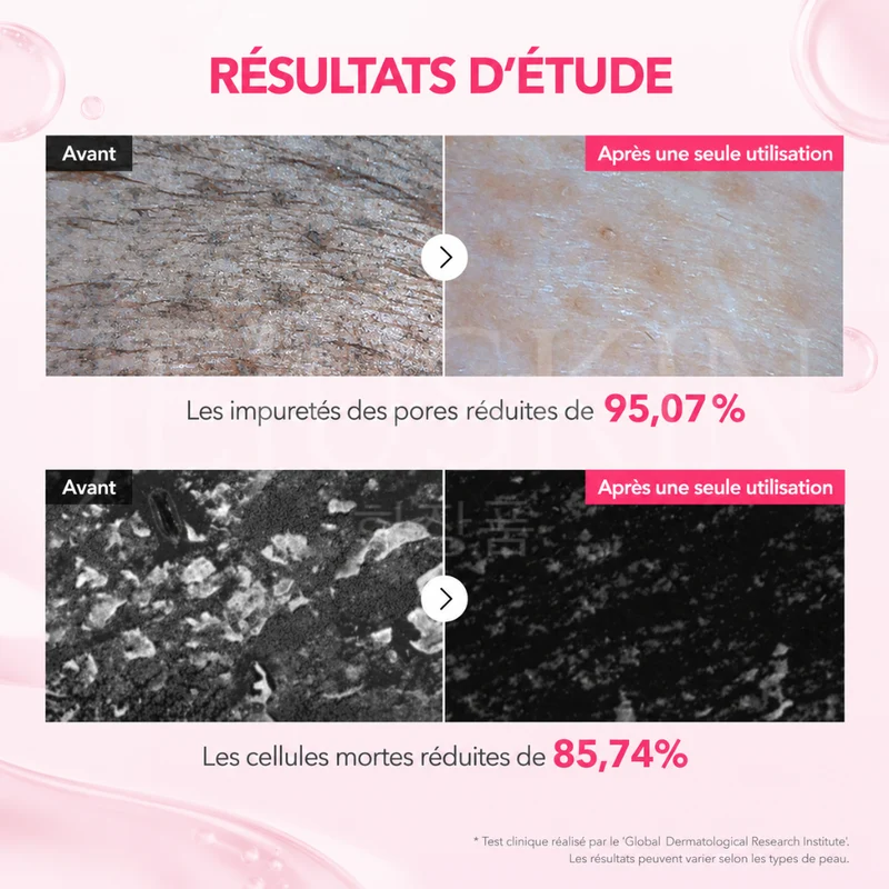 Aprilskin - Nettoyant visage purifiant au TXA et à la niacinamide - 120g