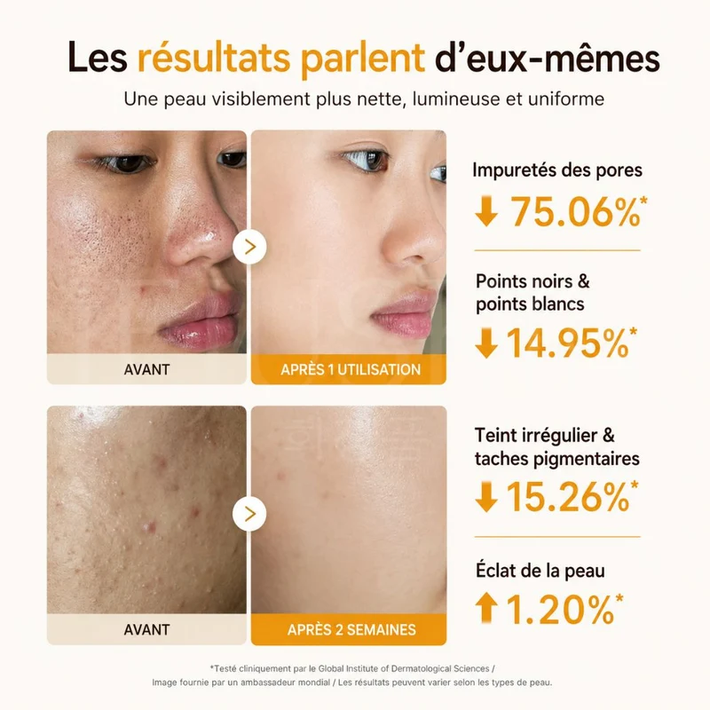 Medicube - Peeling anti-taches à l’acide kojique et curcuma - 80ml