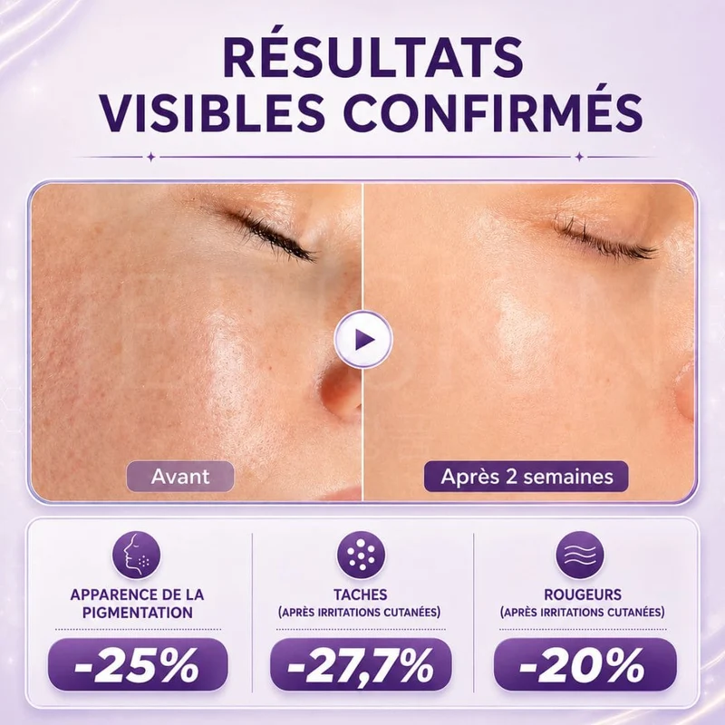 Jumiso - Sérum anti-taches à la niacinamide 20% - 40ml