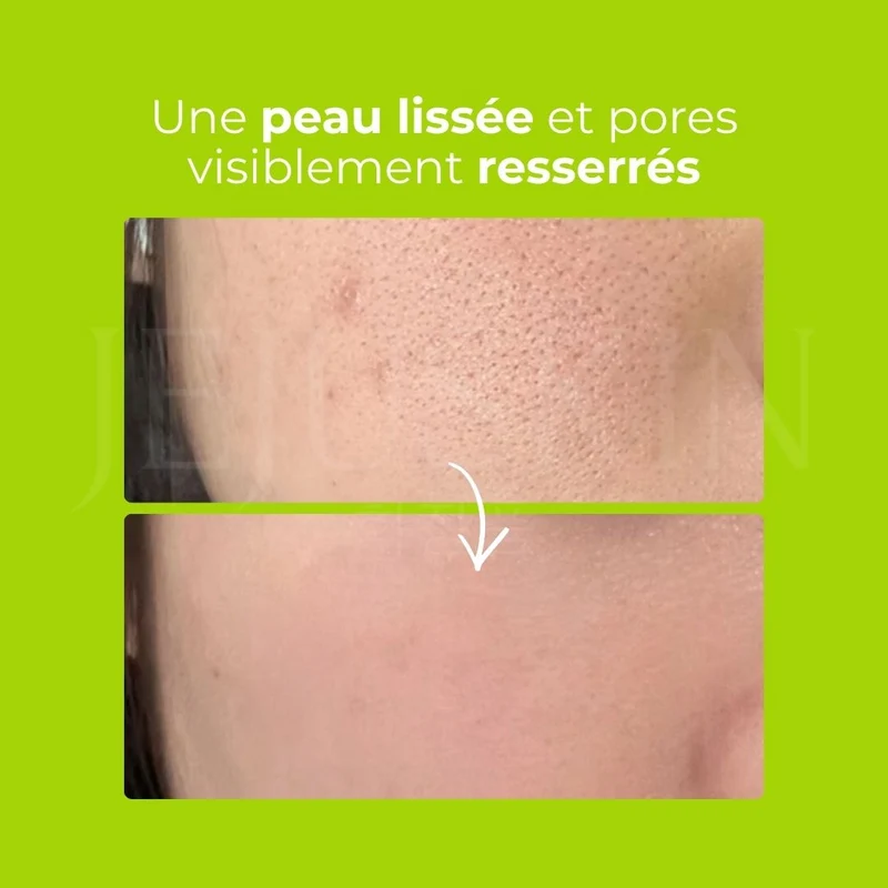 Beplain - Gel exfoliant au lait de haricot mungo - 120ml