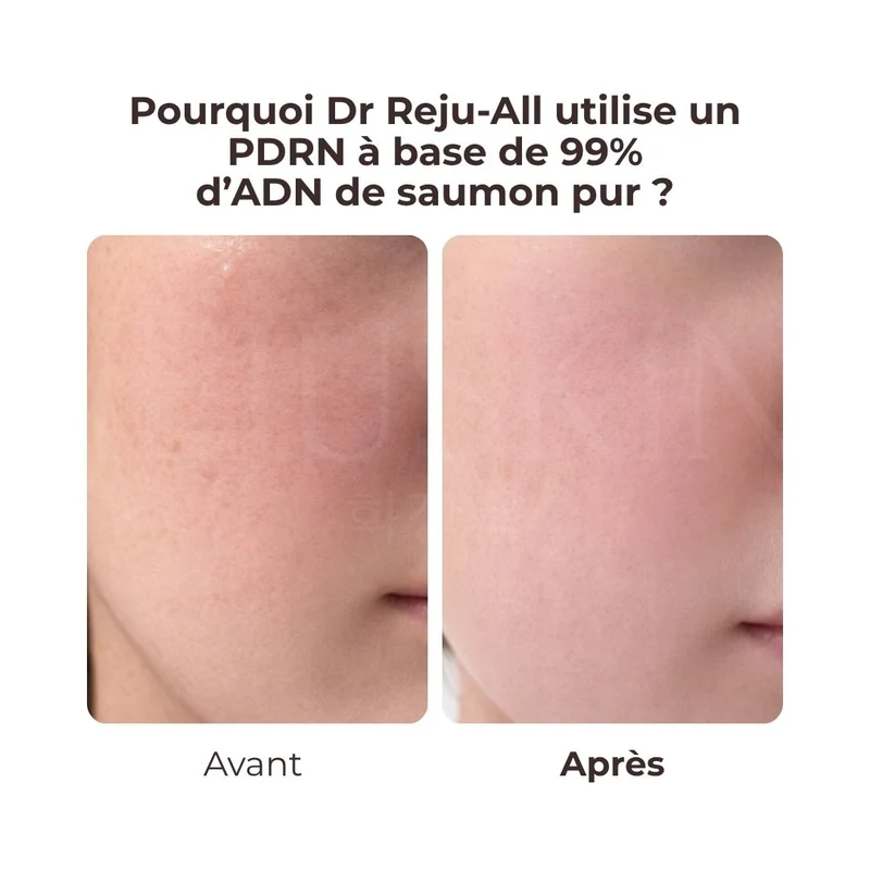Dr. Reju-All - Crème hydratante et régénérante au PDRN - 60ml