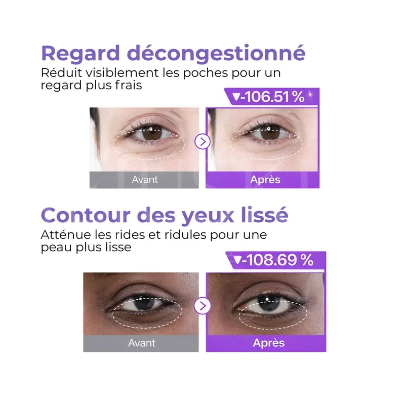 Numbuzin - Patchs contour des yeux revitalisants NAD+ et collagène N°9 - 5 paires