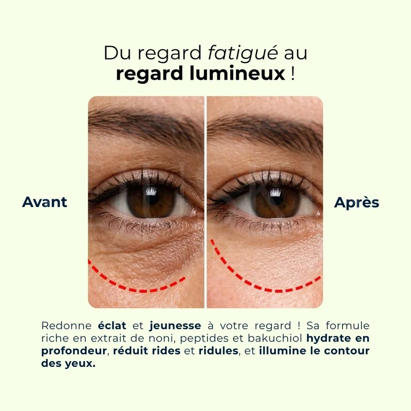 Celimax - Crème contour des yeux Noni Ultimate, anti-rides et hydratante - 20ml