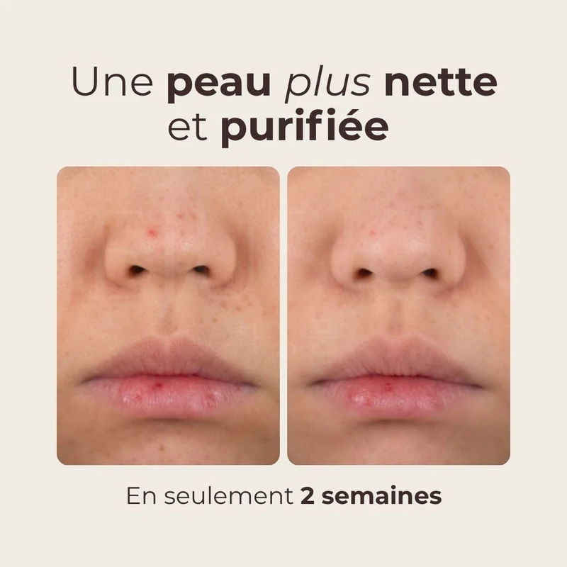 Mizon - Toner lacté éclat à l’eau de riz - 150ml
