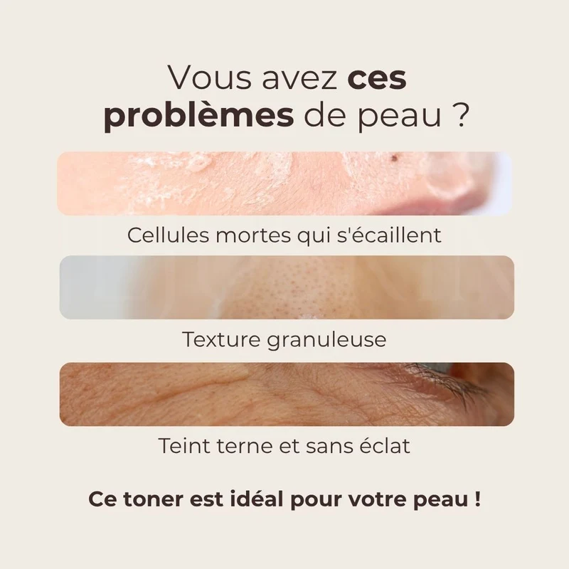 Mizon - Toner lacté éclat à l’eau de riz - 150ml
