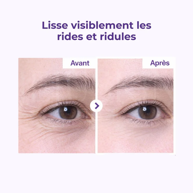 Numbuzin - Crème contour des yeux anti-âge au rétinol et NAD+ N°9 – 10ml