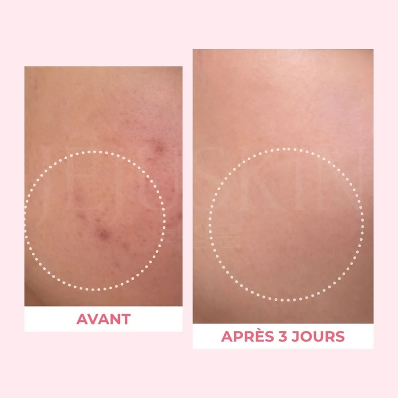 Medicube - Crème capsule au collagène PDRN - 55g