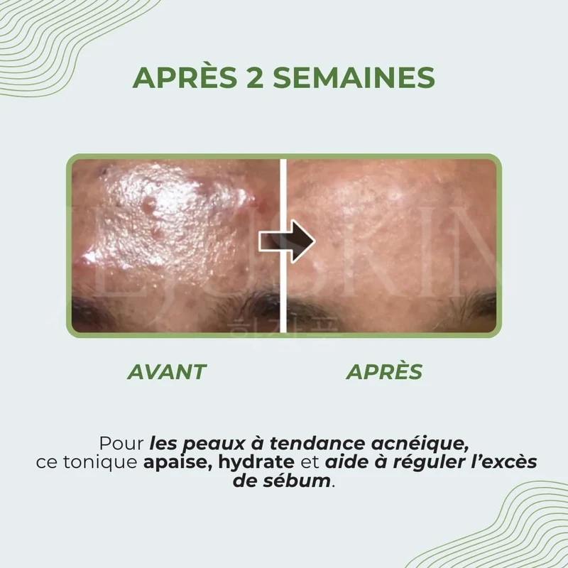 Numbuzin - Toner apaisant aux herbes Pure-Full - 300ml