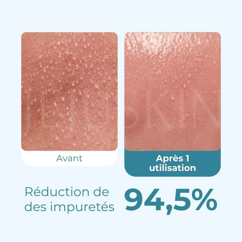 Medicube - Huile nettoyante anti-points noirs Zero Pore - 205ml