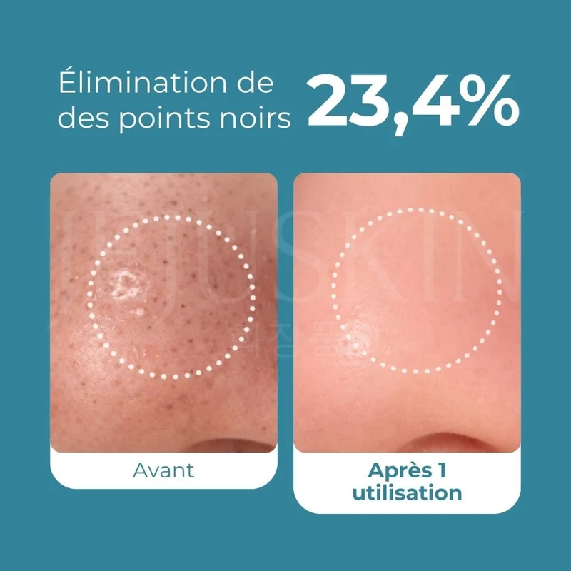 Medicube - Huile nettoyante anti-points noirs Zero Pore - 205ml