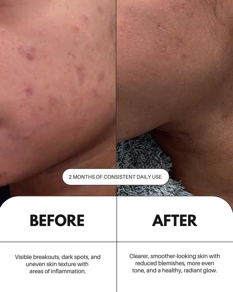 Sérum à la vitamine C pour le visage