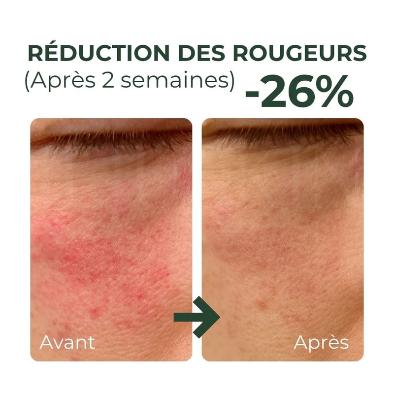 Purito SEOUL - Crème apaisante pour le contour des yeux à la Centella - 30ml