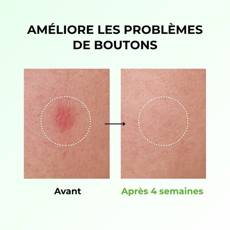 Anua - Toner apaisant à l’acide azélaïque 3% et à la Centella Cica - 250ml