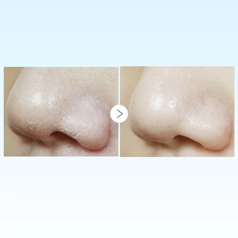 Medicube - Mousse nettoyante Zero - 120ml