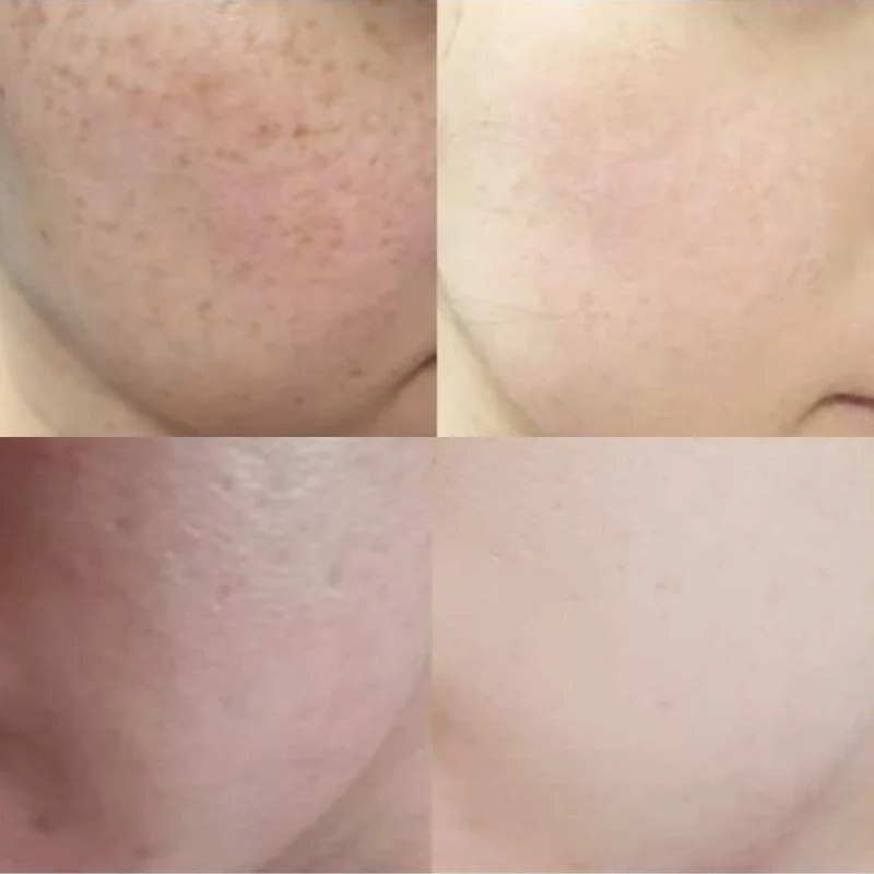 Cell Happy Co - Crème hydratante anti-tâches - 50g