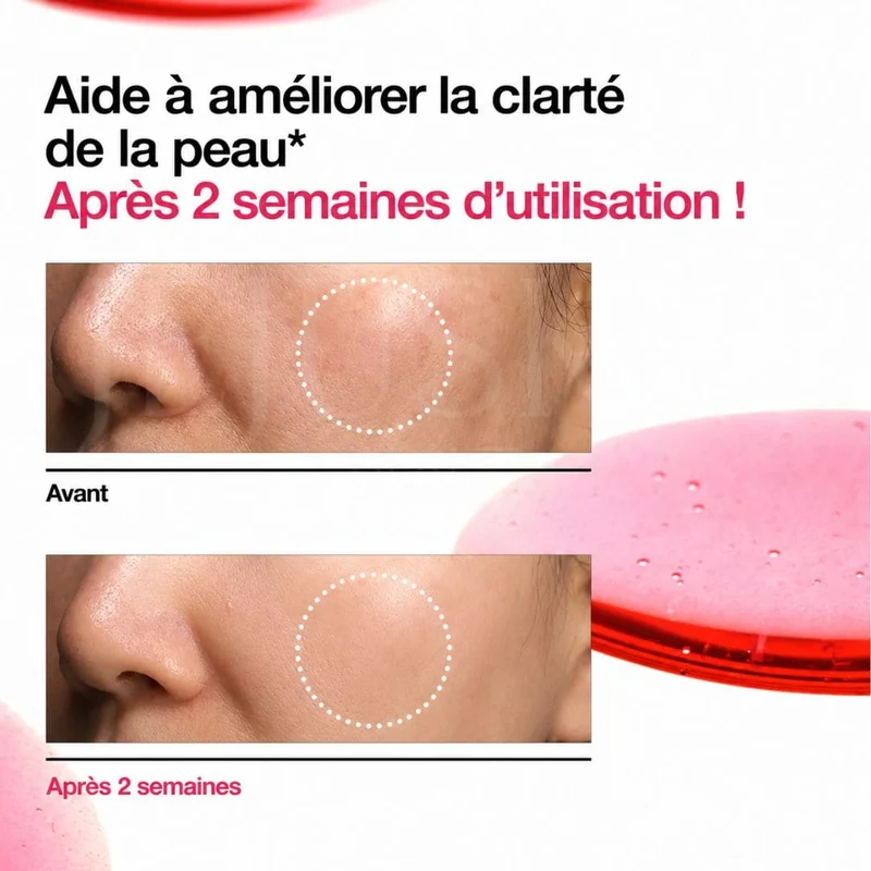 Anua - Sérum anti-tâches à la Niacinamide 10% + TXA 4% - 30ml