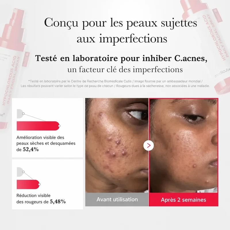 Spray anti-imperfections à l’acide hypochloreux