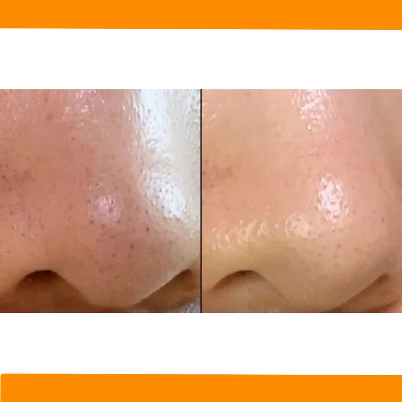 Aprilskin - Baume nettoyant et hydratant Carrotene IPMP - 90ml