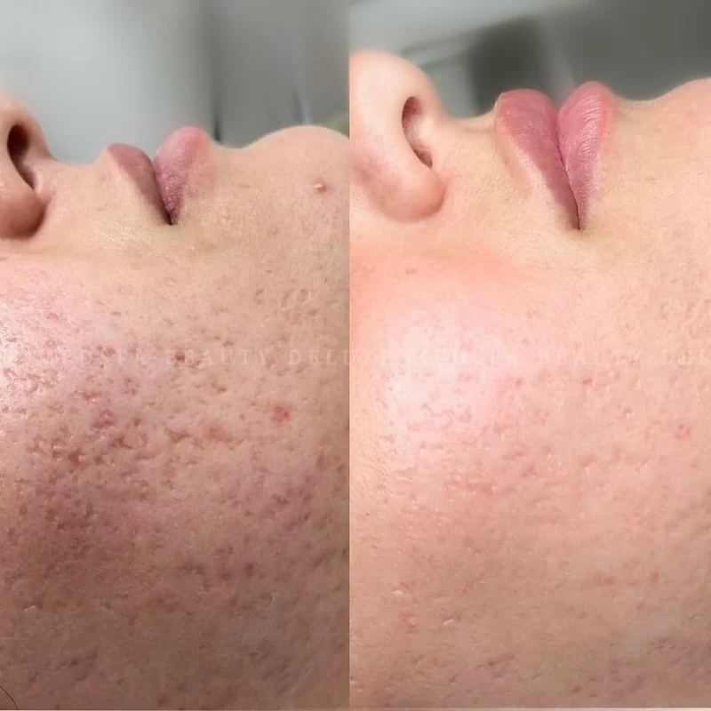 Axis-Y - Peeling éclat rénovateur PHA - 50ml