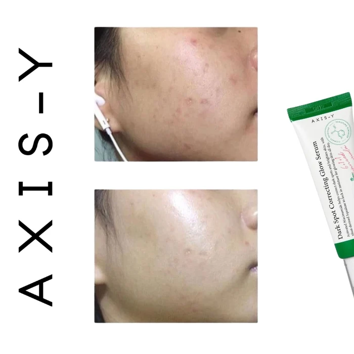 Axis-Y - Sérum lissant correcteur de taches brunes - 50ml