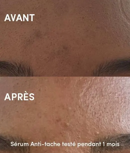 Sérum Anti-Tache Unifiant Vitamine C et Busserole - WAAM Signature