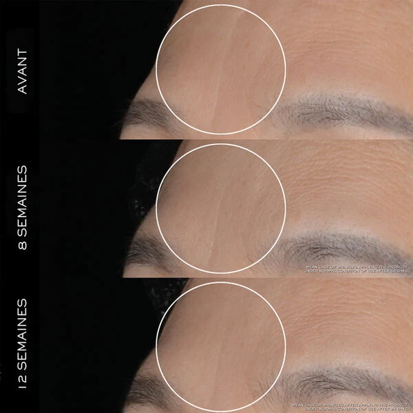 Lancôme Rénergie - Crème H.P.N 300-Peptide Anti-Age