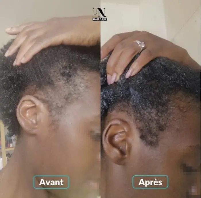 Gélules Pousse & Volume Cheveux Cure 1 mois - In Haircare