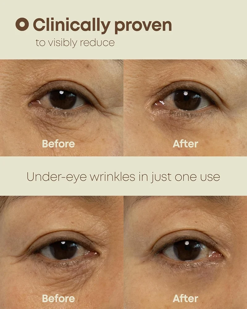 Contour des Yeux Ever-Youth