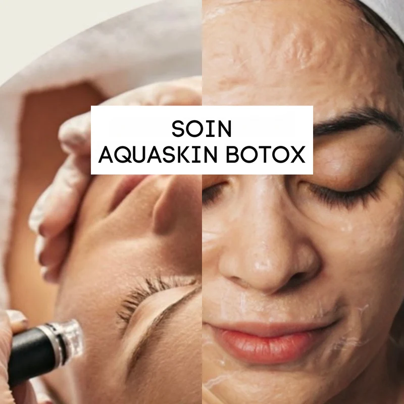 Soin combiné Aquaskin Botox 135€ (acompte 40€)