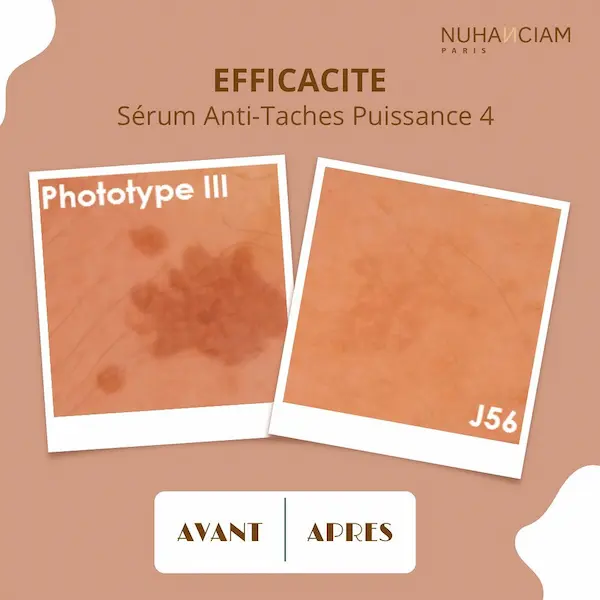 Sérum Anti-Taches Puissance 4 - Nuhanciam