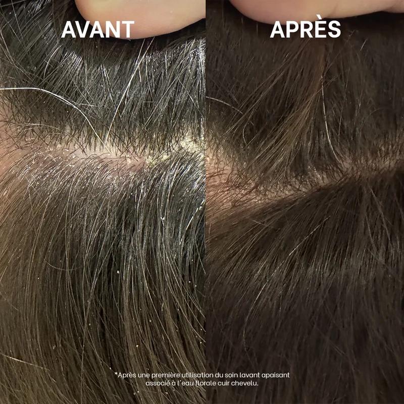 Routine anti-pelliculaire