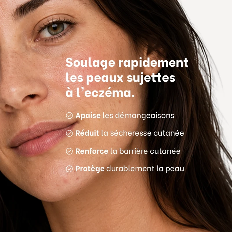 Routine SOS eczéma, psoriasis