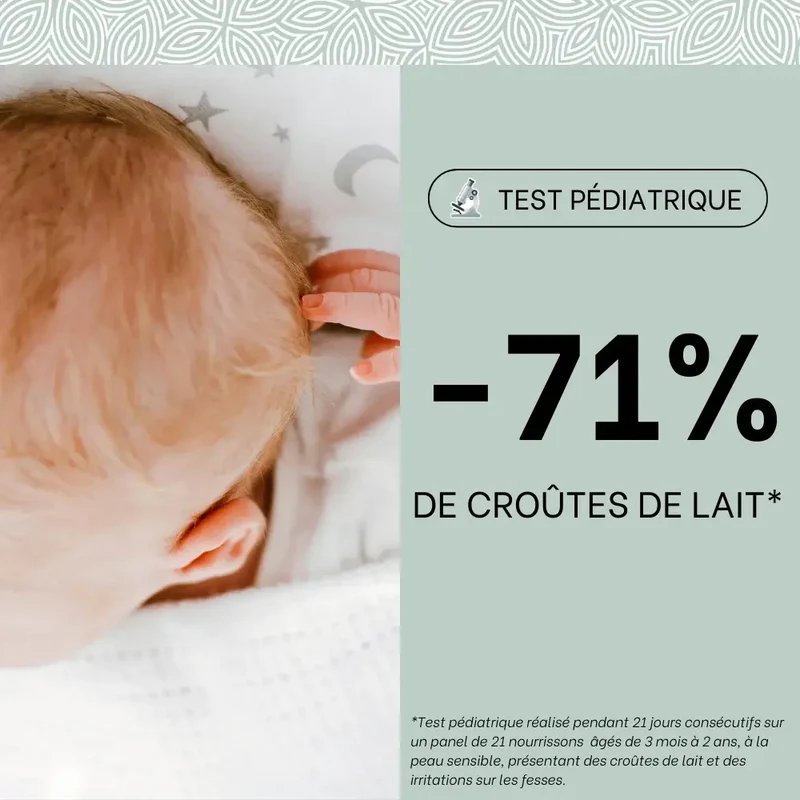 Les soins croûtes de lait