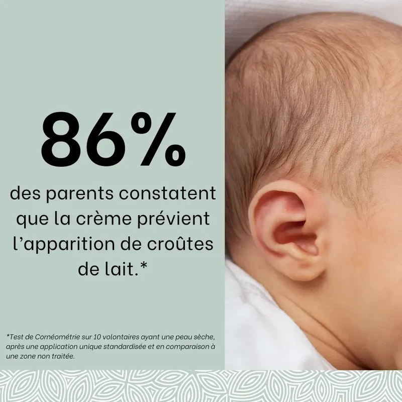 Les soins croûtes de lait