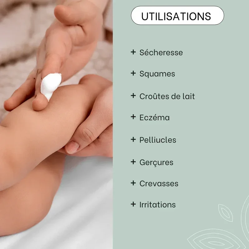 Crème riche SOS sécheresses, squames - 150mL - Bébé
