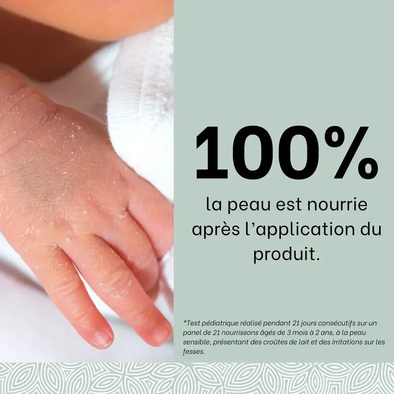 Crème riche SOS sécheresses, squames - 150mL - Bébé
