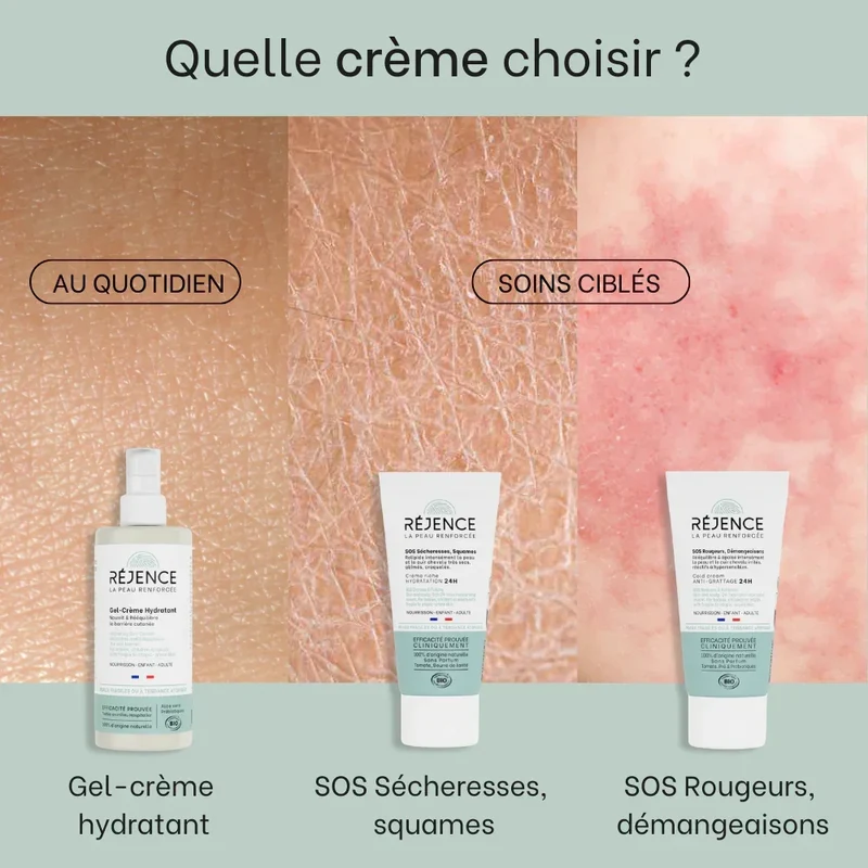 Crème riche SOS sécheresses, squames - 150mL - Bébé