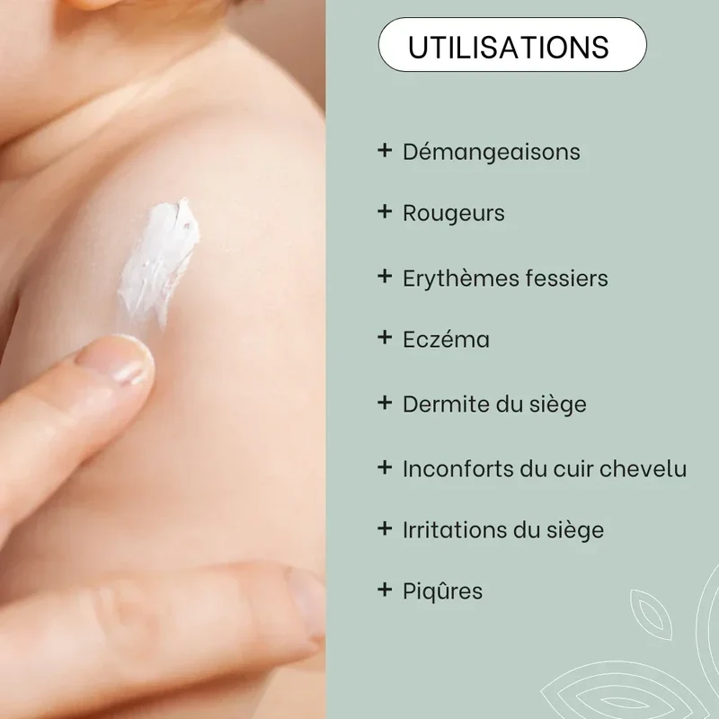 Cold cream SOS rougeurs, démangeaisons - 150mL - Bébé