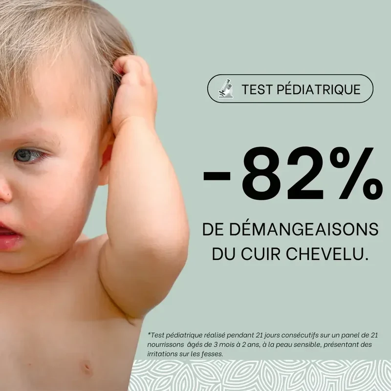 Cold cream SOS rougeurs, démangeaisons - 150mL - Bébé