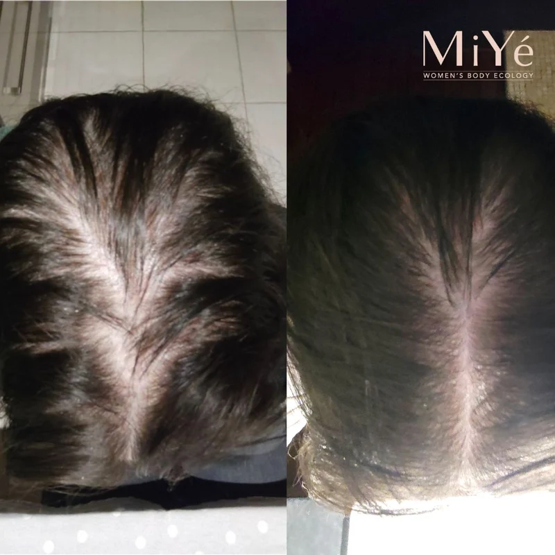 [MY] Sérum Cheveux Densifiant Anti-Chute
