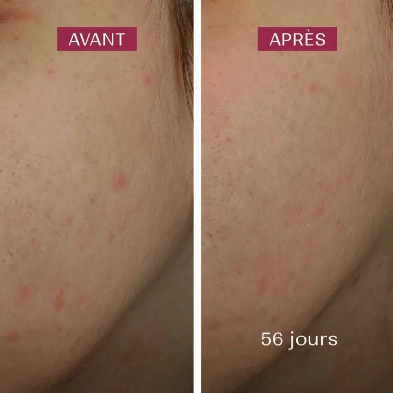 Sérum Anti-Taches
