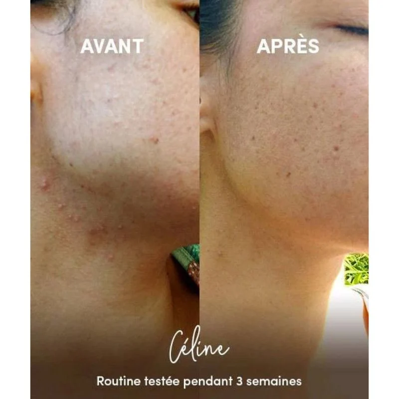 Nettoyant Anti-imperfections en Poudre