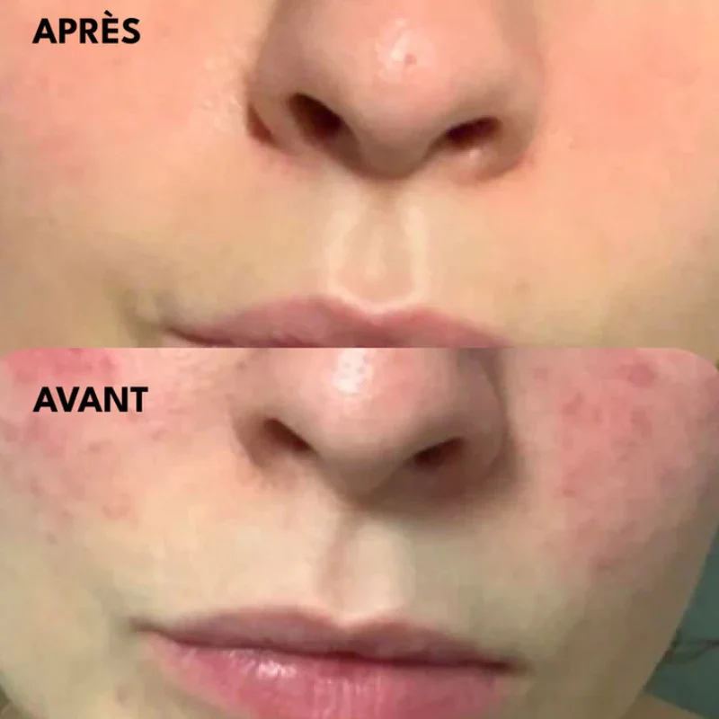 Crème Légère - Crème Matifiante & Anti-Imperfections