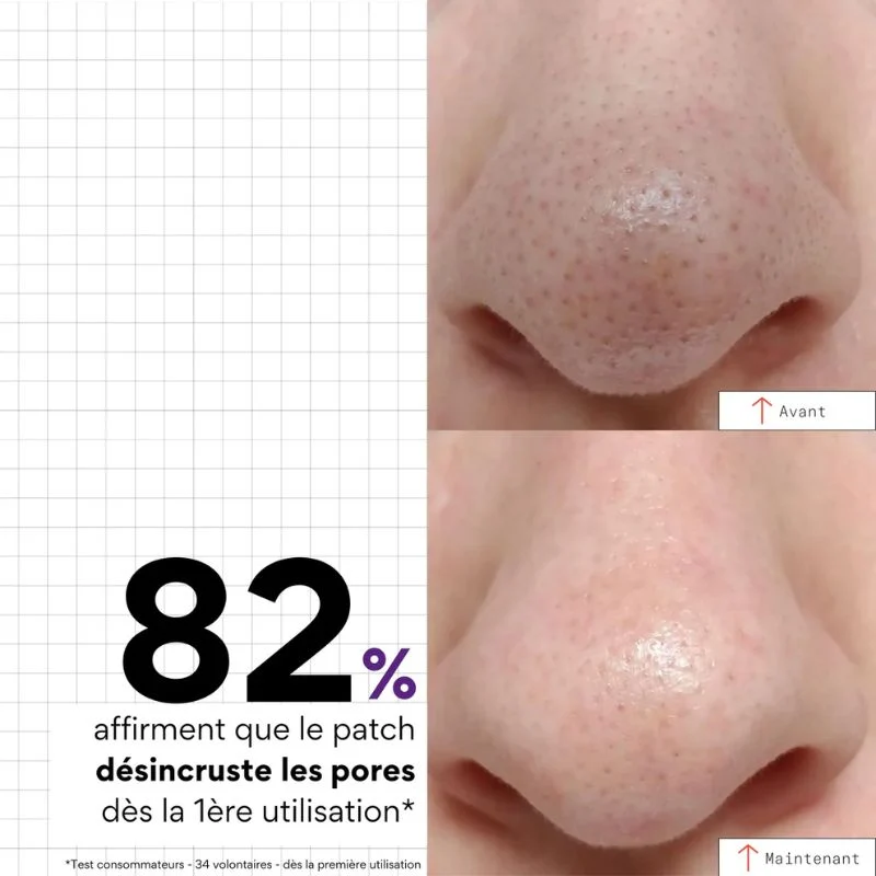 PEEL OUT - Patchs Nez Purifiants