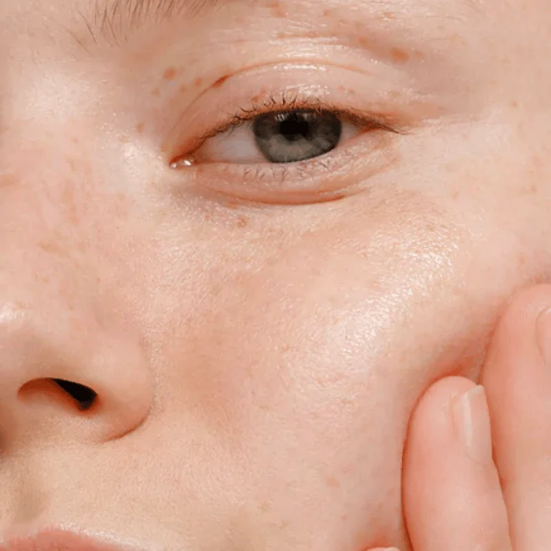 Sérum Botanique Alternatif Niacinamide 5 en 1