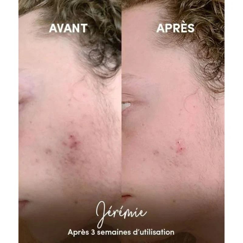 Masque Purifiant en Poudre