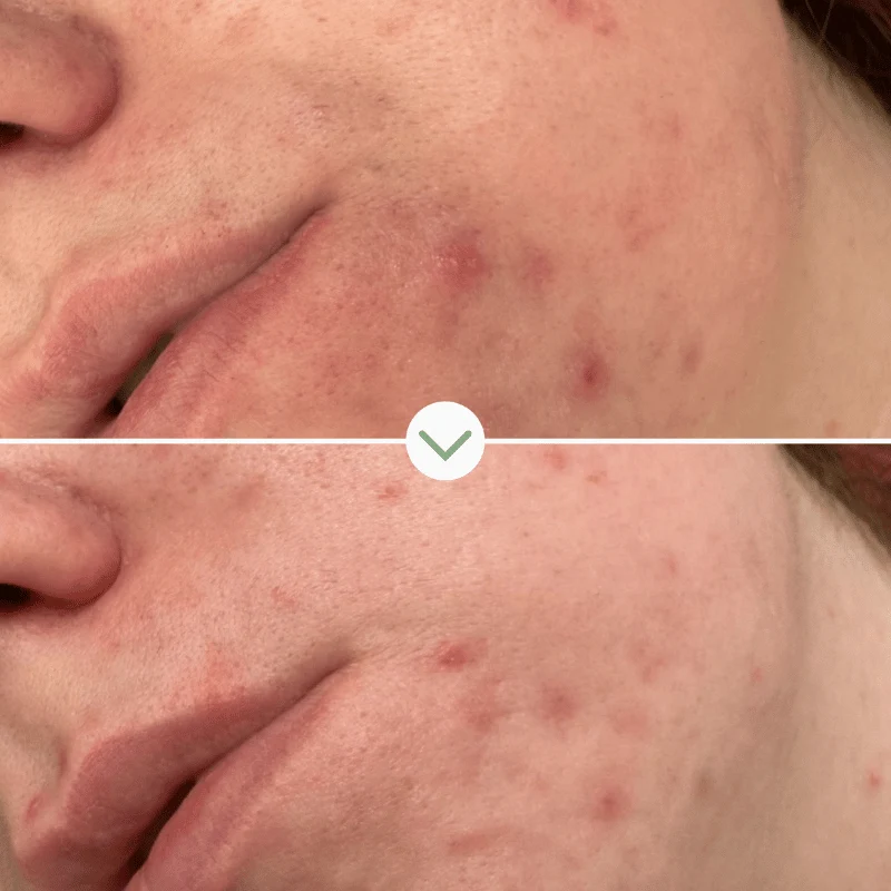 Phaze - Gel Nettoyant Purifiant