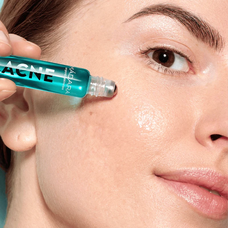 Roll-on Acne Spot